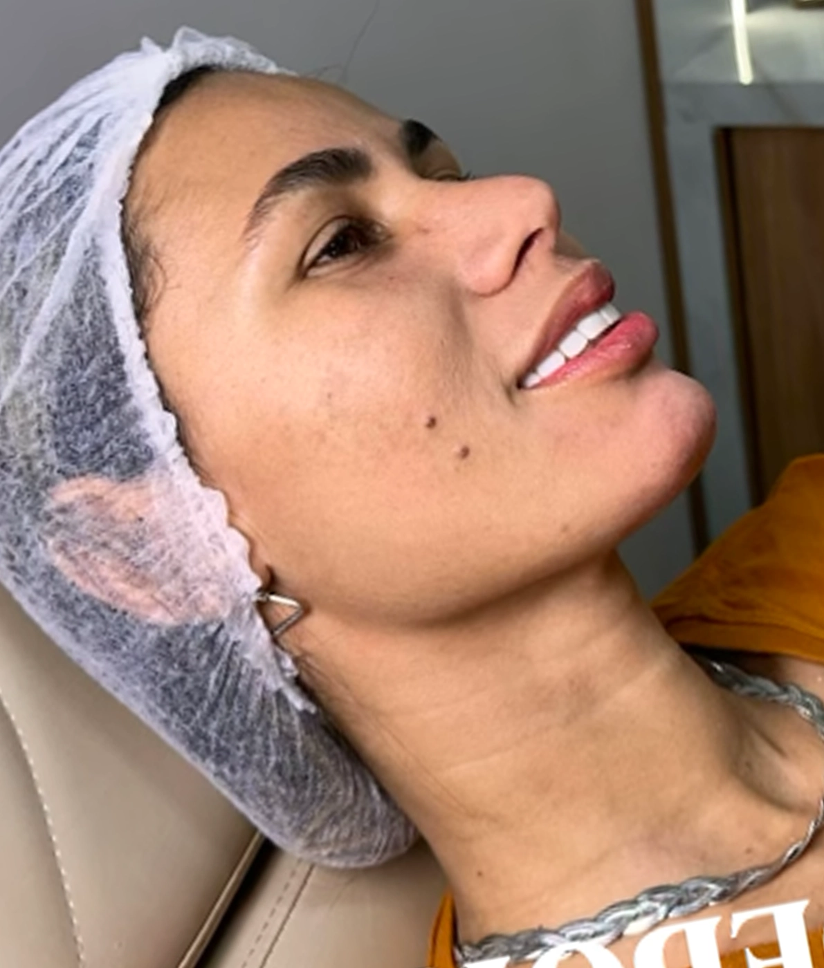 Paceiente 01 Depois 3